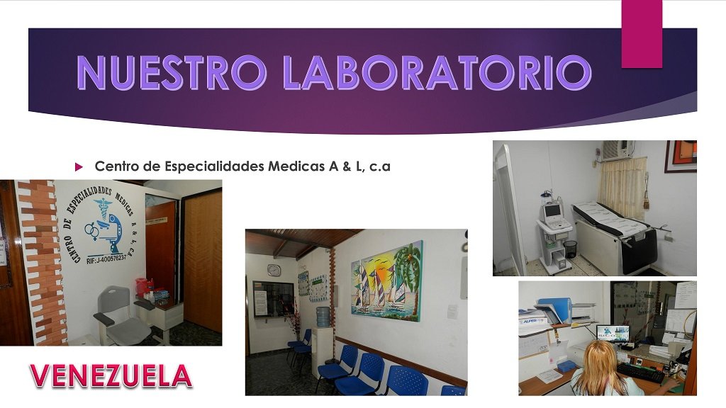 diapositiva8
